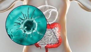 what tests to perform for parasites