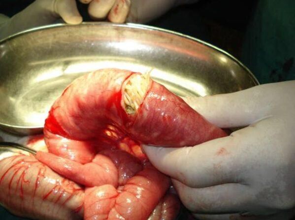how dangerous the worms are dangerous