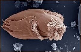 Pathogenic microorganisms in man