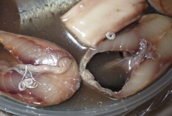 Routes of human infection by parasites