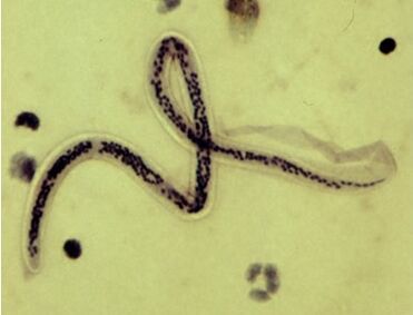 Bancroft heartworm