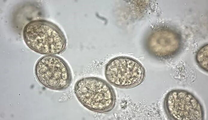 parasites under the microscope