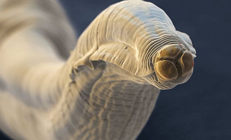 parasitic worm from the human body