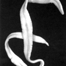 Ribbon parasites in the human body