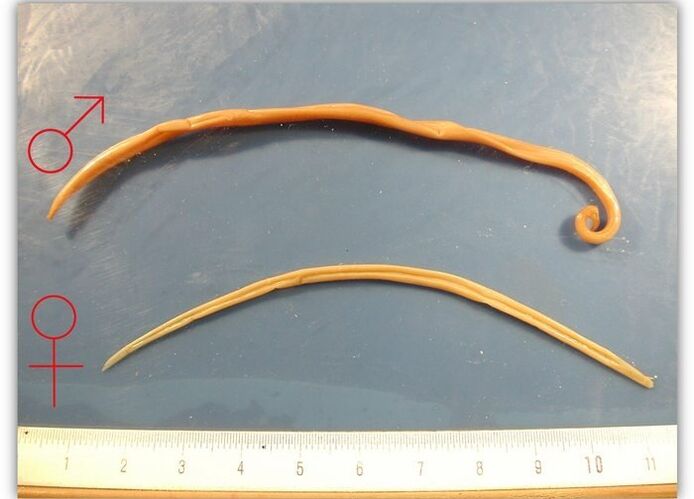 Sizes of nematode worms that infect the respiratory tract of adults